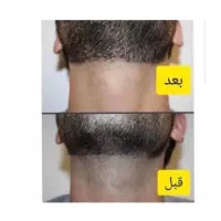 لیزر موهای زایید 390(با ضمانت نامه برگشت وجه)