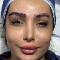 مشاوره کاشت مو،ابرو و کلیه خدمات زیبایی رایگان|خدمات آرایشگری و زیبایی|مشهد, فرهنگ|دیوار