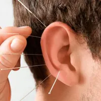 دوره تخصصی طب سوزنی با ارائه مدرک بین‌المللی|خدمات آموزشی|تهران, پیروزی|دیوار