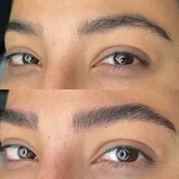 تخفیف فیبروز و میکروبلیدینگ ابرو به روش تاربه تار