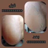 پدیکور تخصصی پا در حمیدیان