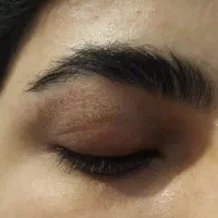 کک و مک،پلاسما،خالبرداری،جوانسازی|خدمات آرایشگری و زیبایی|شیراز, ستارخان|دیوار