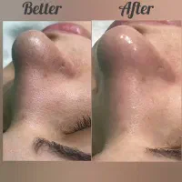 فیشال و پاکسازی پوست