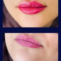 کلینیک زیبایی نُوا