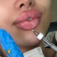 تزریق ژل وفیلر بادی و نخ و لیزر با دستگاه الکس۲۰۲۳|خدمات آرایشگری و زیبایی|تهران, تهرانپارس غربی|دیوار