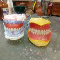 دندان سازی با ت،خ،ف،ی،ف ویژه