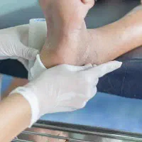 کارشناس زخم دیابتی/زخم بستر در منزل