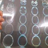 خرید و فروش ضایعات عکس رادیولوژی حمید رضا