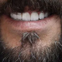 دندانپزشکی اقساطی ایمپلنت عصبکشی روکش قسطی