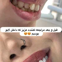 کامپوزیت تخفیف|خدمات آرایشگری و زیبایی|خرم‌آباد, |دیوار