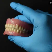 ساخت دندان مصنوعی