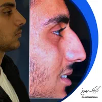 تخفیف 50%|خدمات زیبایی و سلامت|کرمانشاه, |دیوار