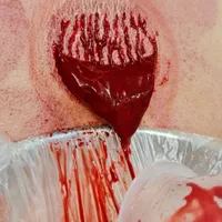 حجامت و بادکش تخصصی در محل شما