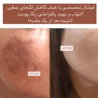 پاکسازی پوست در کلینیک زیبایی
