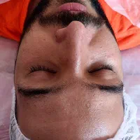 فیشیال تخصصی بانوان و آقایان در مطب ،آموزش ۵ تومن|خدمات زیبایی و سلامت|تبریز, |دیوار