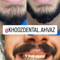 اگر دنبال درآمد/کار/حقوق و پول هستی کپشن بخون|استخدام بازاریابی و فروش|اهواز, کیانپارس |دیوار