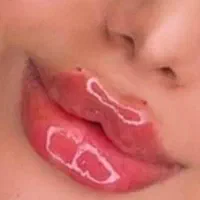 تزریق ژل فیلر مزوژل جوانساز بوتاکس لب روسی مزو مو|خدمات آرایشگری و زیبایی|کرج, گلشهر|دیوار