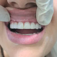 آموزش کامپوزیت دندان۱۰تومن|خدمات آموزشی|اهواز, رسالت|دیوار