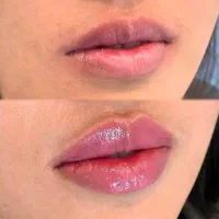 کلینیک زیبایی دکتر نازنین نعمتی/خدمات بوتاکس،ژل،نخ|خدمات آرایشگری و زیبایی|تهران, مرزداران|دیوار