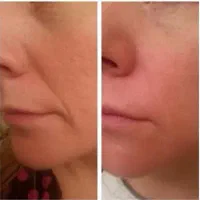 کرم رفع چین و چروک صورت|آرایشی، بهداشتی، درمانی|تبریز, |دیوار