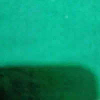 کارآموز تزریقات و پوست ومو