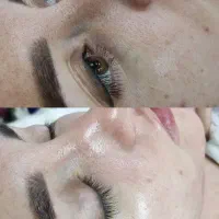 فیشیال تخصصی فقط 300