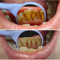 جشنواره دندانپزشکی