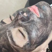 کربن تراپی ، جوانسازی