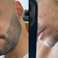از ریش کم پشت تا ریش پرپشتت با ما