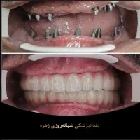 دندان پزشکی شبانه روزی زهره