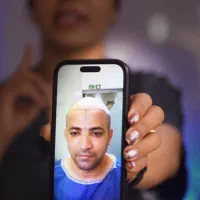 جذب منشی و ادمین کلینیک کاشت مو