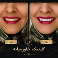 بزرگترین جشنواره سال دندانپزشکی درمجهزترین کلینیک|خدمات زیبایی و سلامت|شیراز, عفیف‌آباد|دیوار