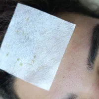 فیشال تخصصی پاکسازی۲۰۰تومان مزو کربوکسی اسیدتراپی|خدمات آرایشگری و زیبایی|مشهد, هدایت|دیوار