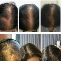 تونیک گیاهی هیرفرند اصل تقویت و رشد مو