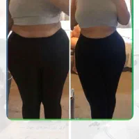 تخفیف یلدایی لیزر و لاغری با تخفیف لیزر بیا