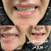 آماده همکاری با دندان پزشکان پرند و رباط کریم