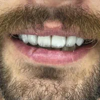 دندانپزشکی،کامپوزیت،عصب کشی(ستارخان)|خدمات زیبایی و سلامت|تهران, شادمان|دیوار