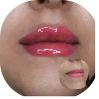 خدمات تتو و ژل و بوتاکس|خدمات آرایشگری و زیبایی|آبادان, |دیوار