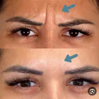 جشنواره ژل و بوتاکس و فیلر بادی(بدن)|خدمات آرایشگری و زیبایی|اصفهان, شهرک کاوه|دیوار