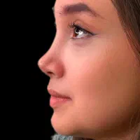 50%تخفیف ویژه عمل جراحی بینی بدون تامپون لیفت|خدمات آرایشگری و زیبایی|فردیس, طالقانی|دیوار