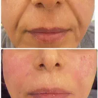 کلینیک زیبایی خدمات فیلر بوتاکس مزوژل PRP|خدمات آرایشگری و زیبایی|اهواز, کیان اباد|دیوار