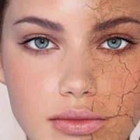 مشاوره پوست و مو|آرایشی، بهداشتی، درمانی|اهواز, زیتون کارمندی|دیوار