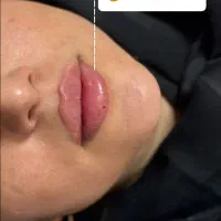 کیلینک زیبایی پاستور تخصصی ترین کیلینک زنجان|خدمات آرایشگری و زیبایی|زنجان, |دیوار