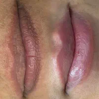 تخفیف ویژه ژل و بوتاکس|خدمات آرایشگری و زیبایی|گنبد کاووس, |دیوار