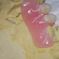 دندان مصنوعی