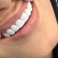 خدمات دندانپزشکی با قیمت مناسب|خدمات آرایشگری و زیبایی|گنبد کاووس, |دیوار