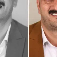 ایمپلنت یک روزه