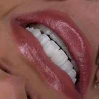 دندان کامپوزیت دندانپزشکی باهوش مصنوعی|خدمات آرایشگری و زیبایی|مشهد, دانشجو|دیوار