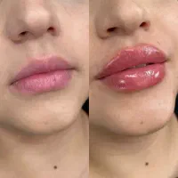 کلینیک آوا بیوتی (تضمینی)با دستگاه الکساندر کندلا|خدمات آرایشگری و زیبایی|تهران, تهرانپارس غربی|دیوار