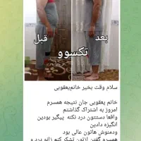 چربیسوزی با تکسوو|آرایشی، بهداشتی، درمانی|قزوین, |دیوار